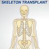 Play Skeleton Transplant